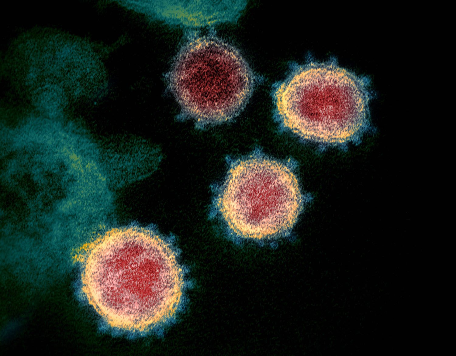 Fotografías Del Coronavirus Bajo El Microscopio – Facultad De Ciencias ...