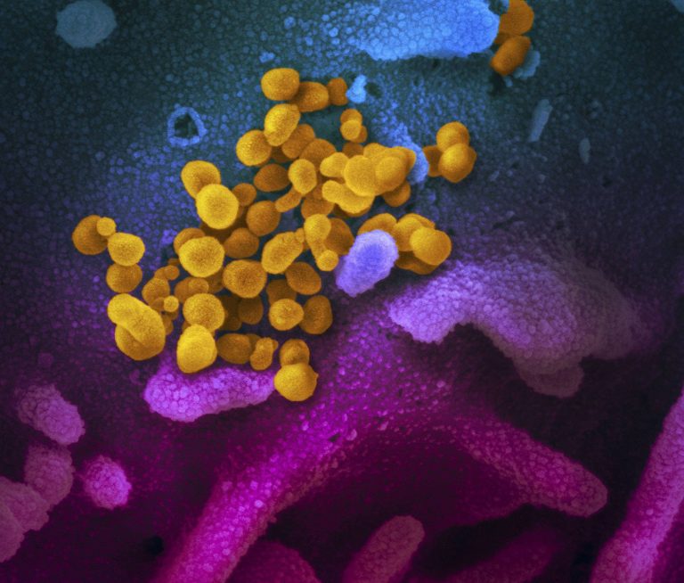 Fotografías Del Coronavirus Bajo El Microscopio – Facultad De Ciencias ...